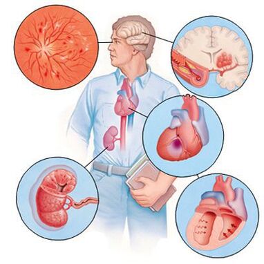 Cardiol preprečuje razvoj sočasnih bolezni